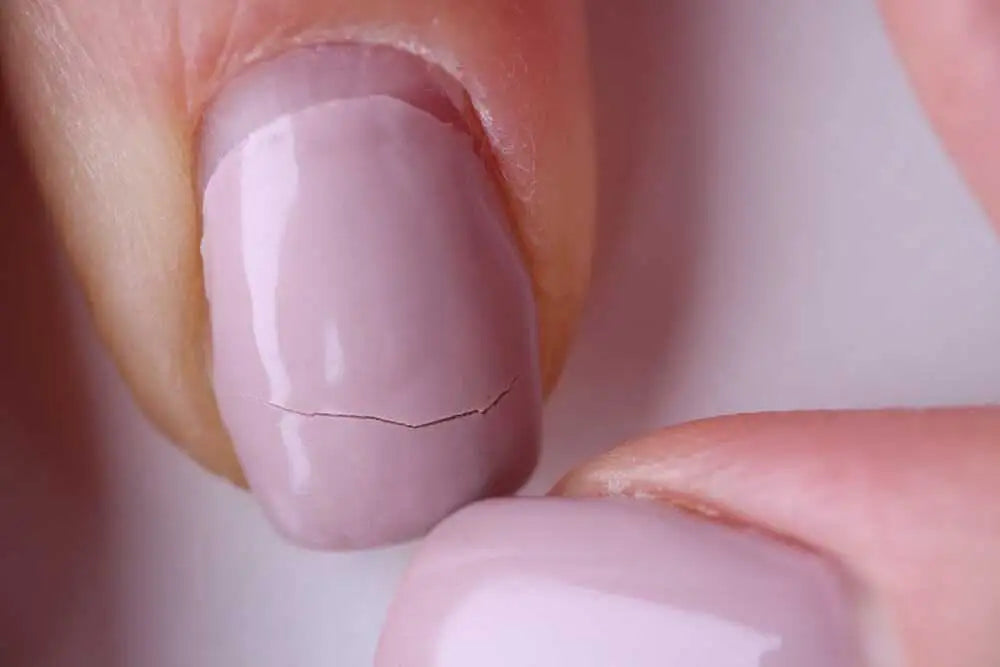 Gyakori problémák és megoldások a DipNails használatánál